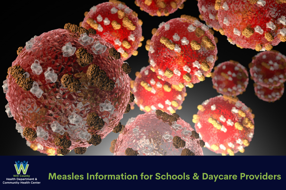 Measles Information For Schools & Daycare